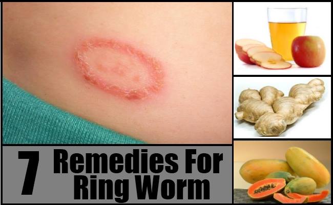 Does Apple Cider Vinegar Cure Ringworm In Dogs
