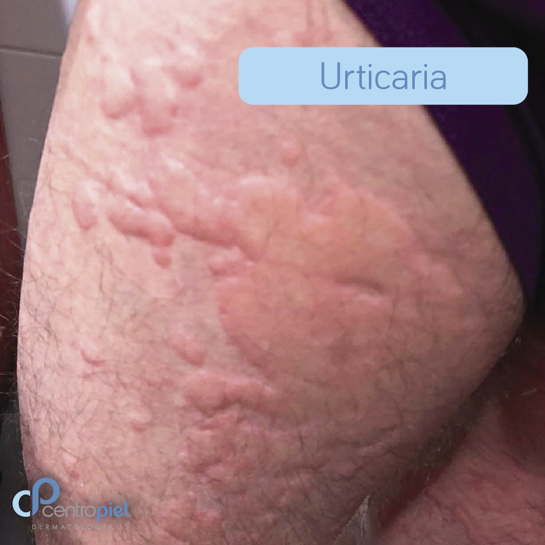 📝 Recomendaciones para pacientes con... - Centro Piel Derma