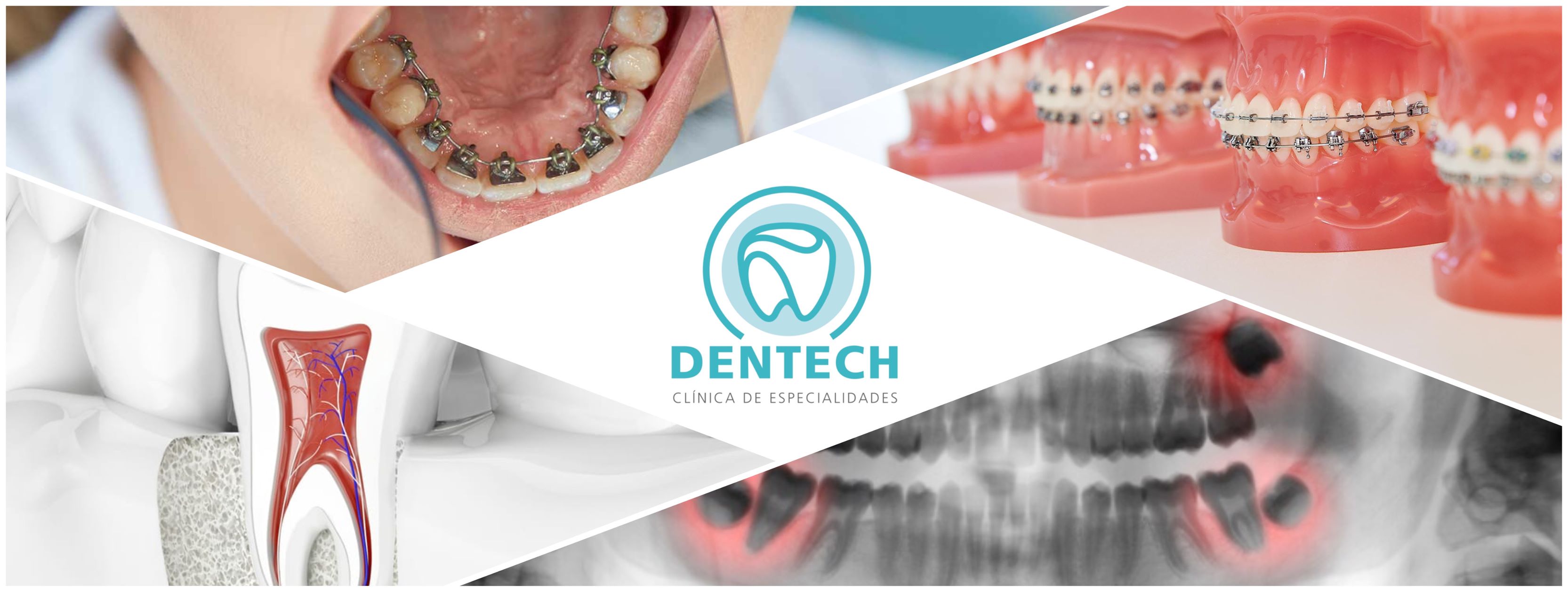 Dentech Clínica de Especialidades