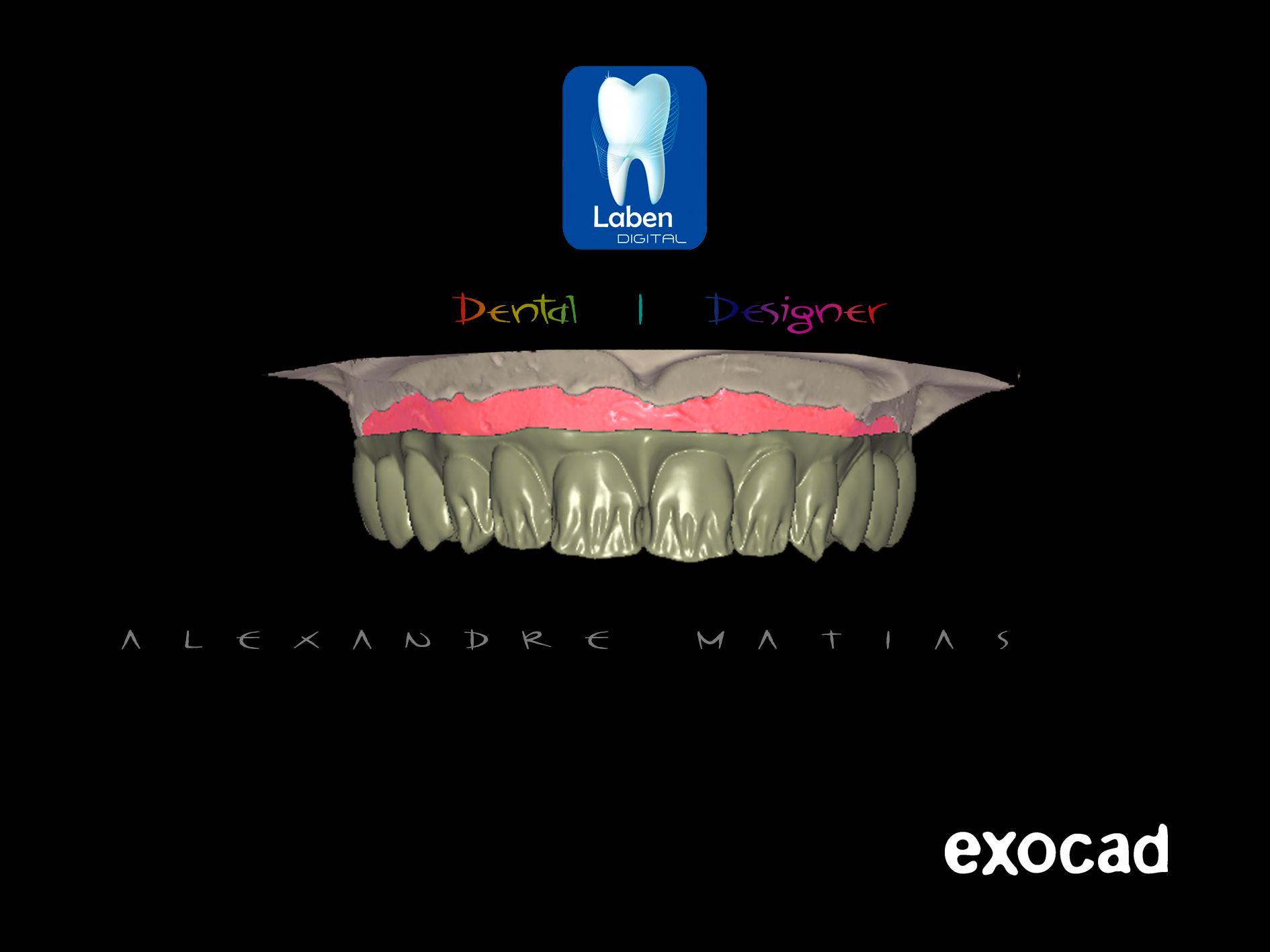 Laben - Laboratório de Prótese Dental - Exocad é atualmente o mais ...