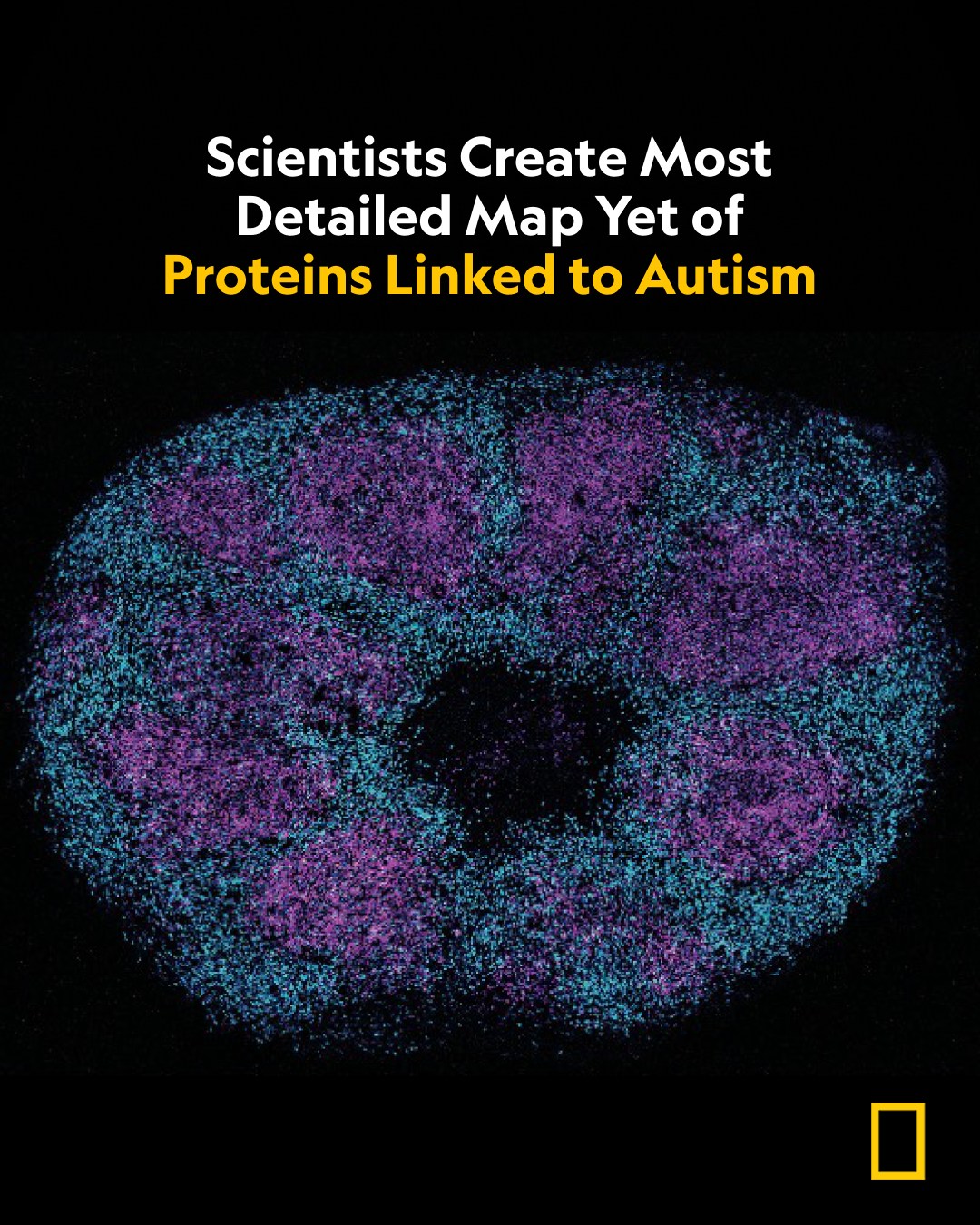 glutathione adhd reddit Scientists have built the most detailed map yet of the proteins tied to autism spectrum disorder—tracking over 1,800 proteins that interact with 100 gene variants. The findings suggest that autism's hundreds of Skin balancing