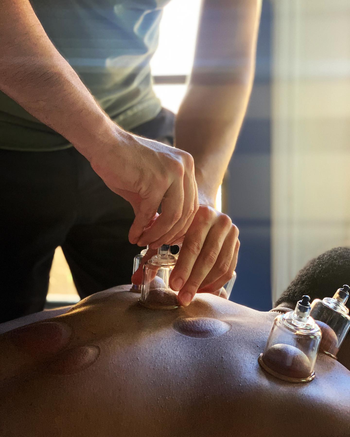 Merit Massage and Bodywork - Cupping Therapy 🍵 📚Cupping relieves muscle ...