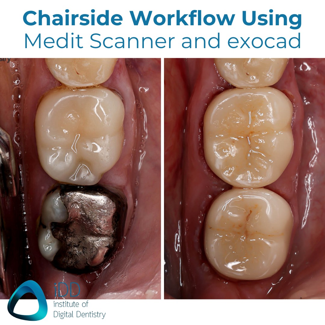 How can you create two... - Institute of Digital Dentistry | Facebook