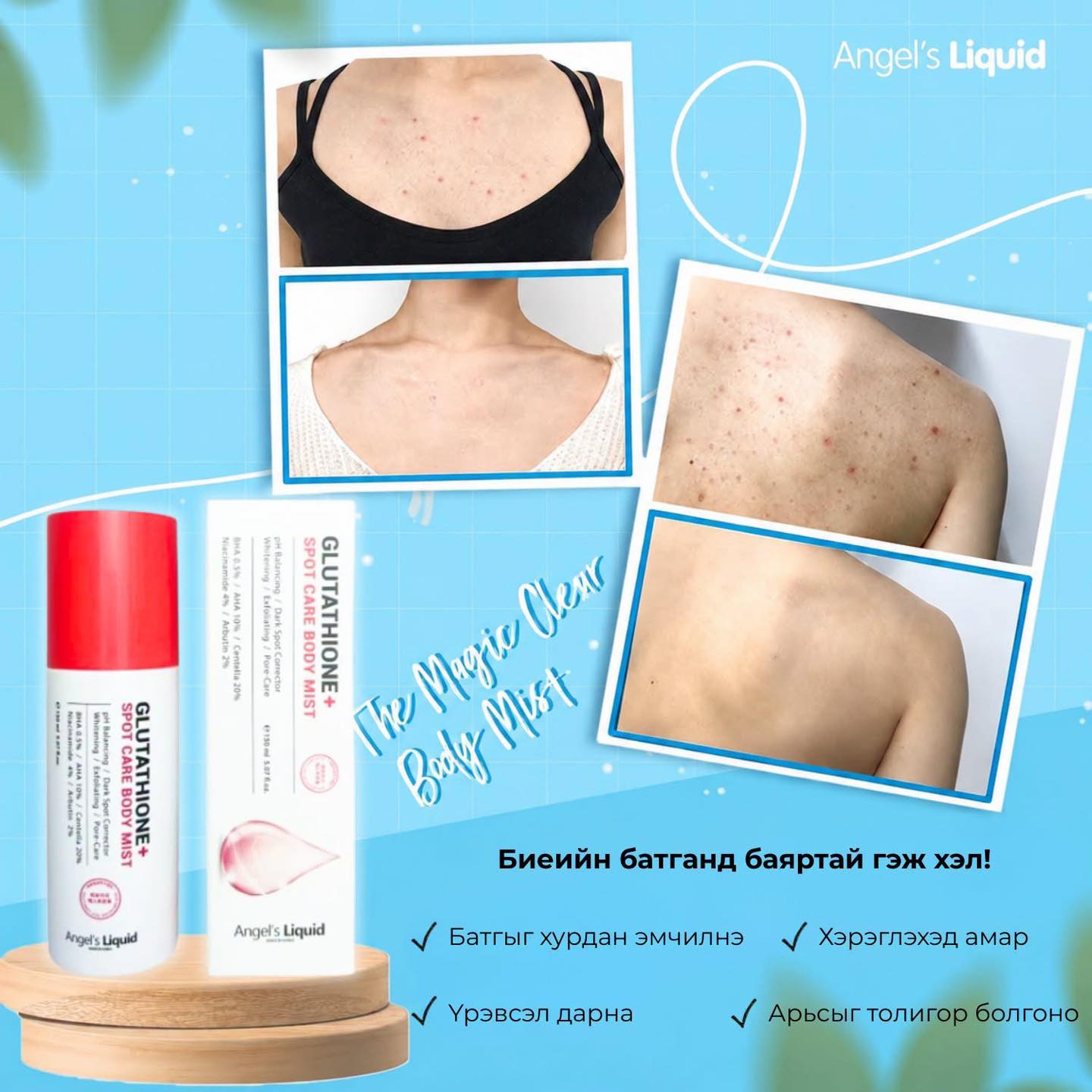 ✨Angel's Liquid Glutathione + Spot Care Body Mist Биеийн батга болон нөсөө толбоноос салах алдартай шийдэл! Зун болон өвлийн аль ч улиралд нуруу, цээж, гар болон биеийн бусад хэсгээр үүссэн батга болон
