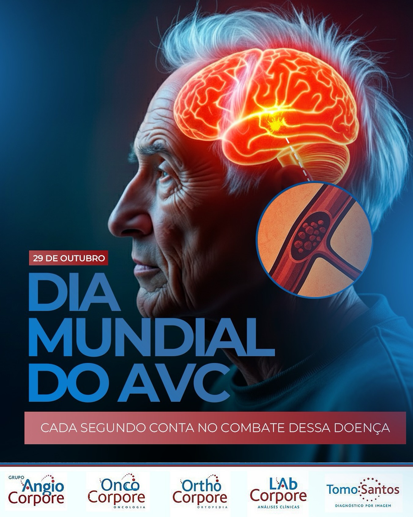 AngioCorpore - Você sabia que o AVC é uma das principais causas de ...