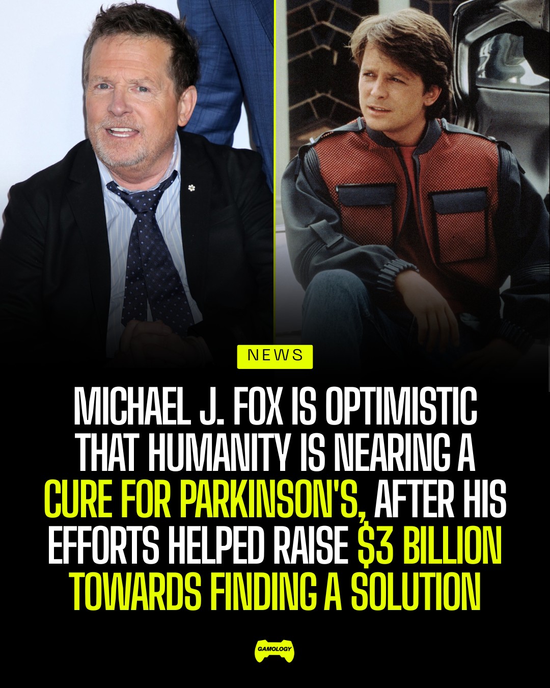 Michael J. Fox continues to use his platform to push for progress against Parkinson's disease, remaining optimistic that researchers can eventually find better treatments and a cure. Fox has acknowledged that living