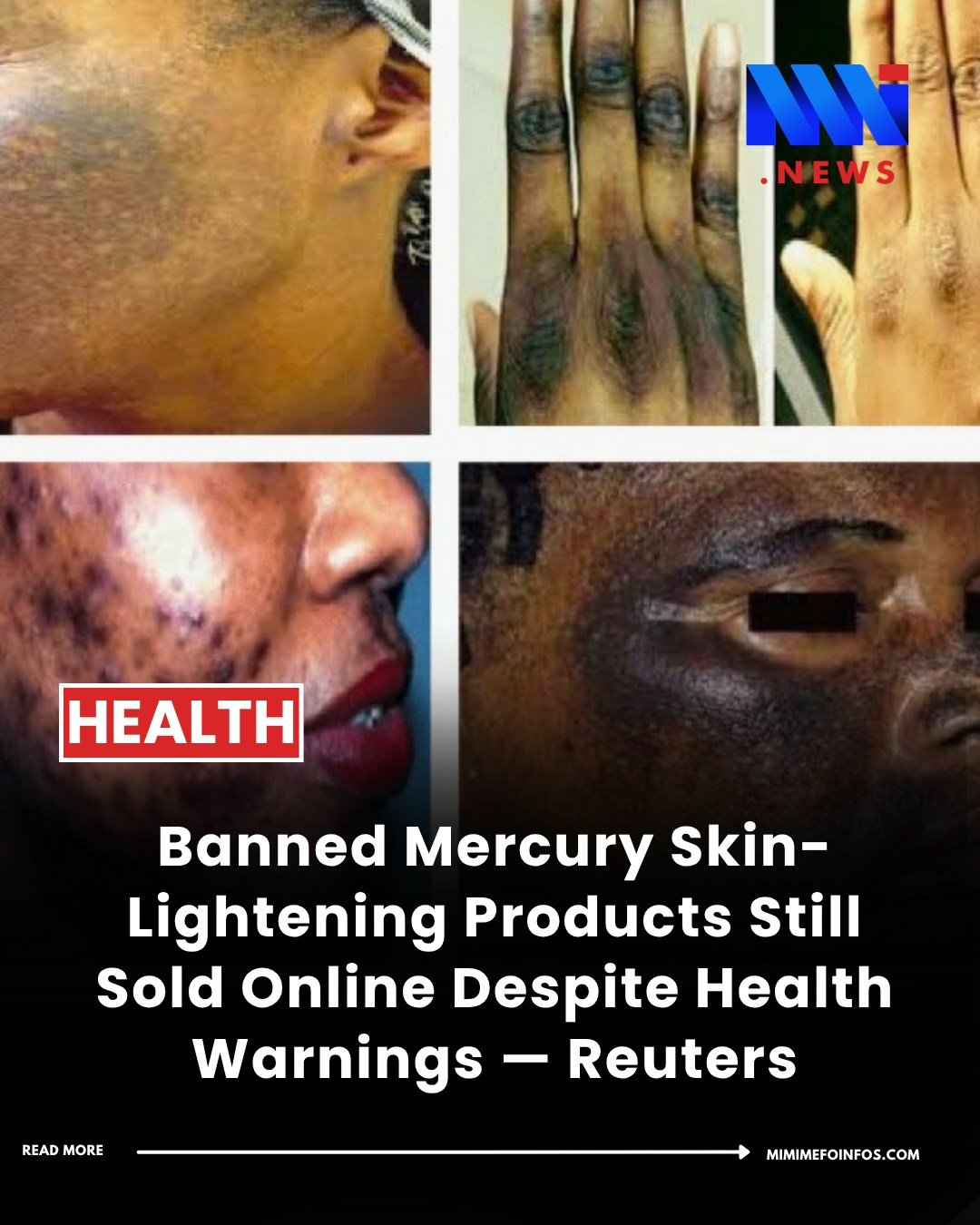 american academy of dermatology glutathione skin lightening warning Did you know that skin-lightening products (bleaching) can damage not only the skin, but also the kidneys, brain and nervous system? More than 20 banned skin-lightening products linked to dangerous levels Volume:10mg