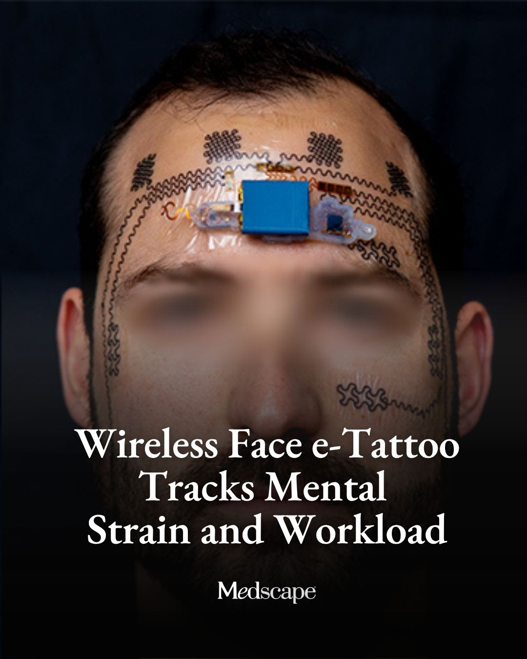 チップ A temporary electronic forehead tattoo that wirelessly measures