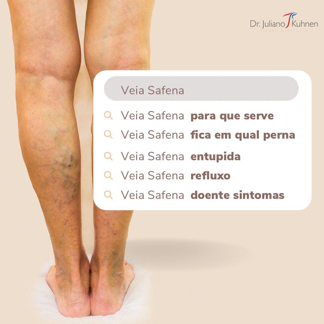 A veia safena é... - Dr. Juliano Kuhnen - Cirurgia Vascular