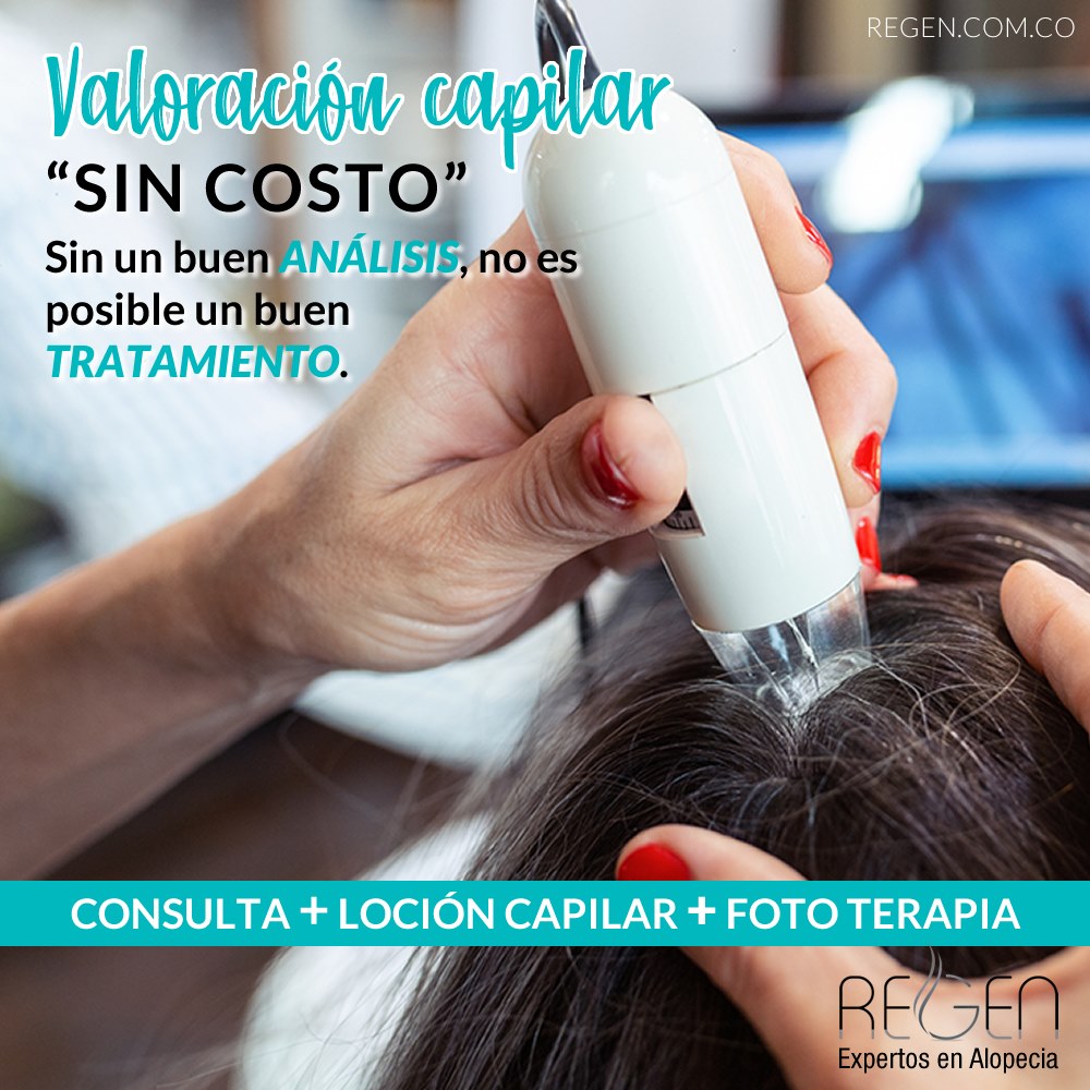 ️En REGEN contamos con los... - REGEN Expertos en Alopecia