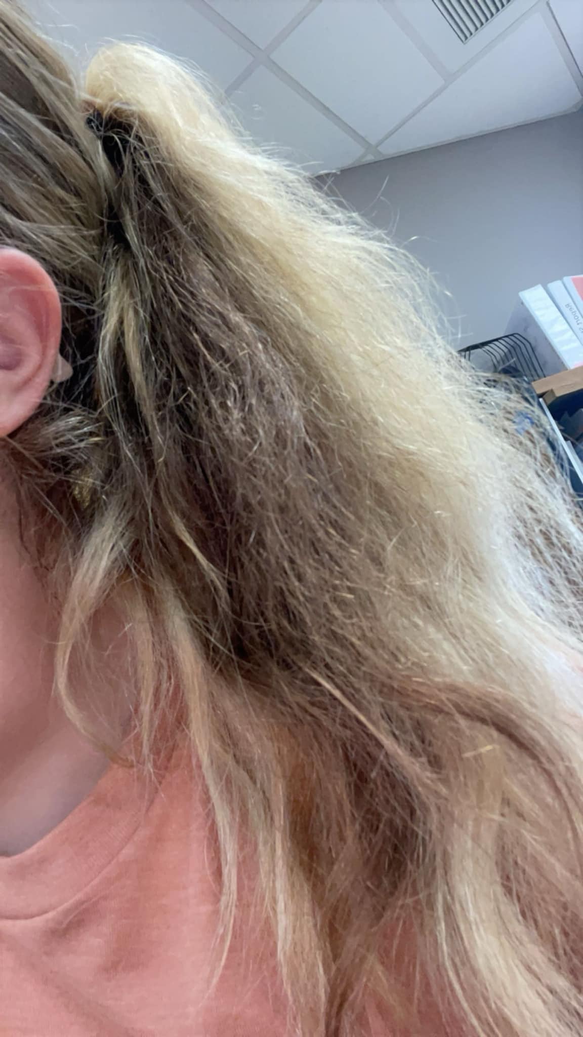 my hair feels like cotton after b12 injections Hi everyone, please help! This is what looks when I let it air-dry a shower. It turns into candy.😑 Does anyone know why this happens or what Type:Injection supplements Buy 5-Amino-1MQ Peptide |
