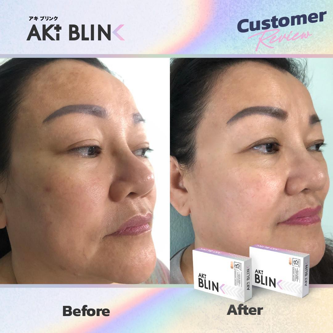 ตั้งแต่กิน AkiPlus + Aki Blink ก็รู้สึกว่า ตัวเองกล้าถ่ายรูป แบบไม่ต้อง ...