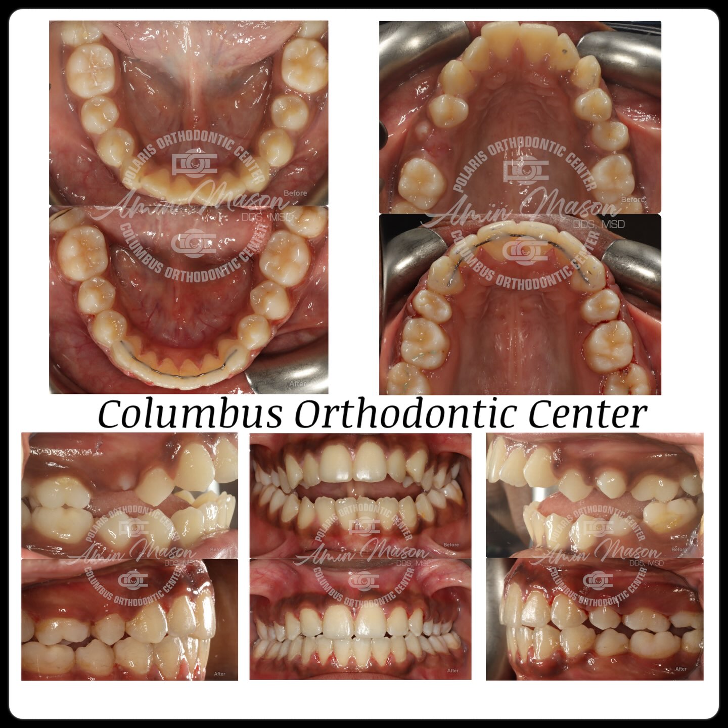 Columbus Orthodontic Center | Columbus OH