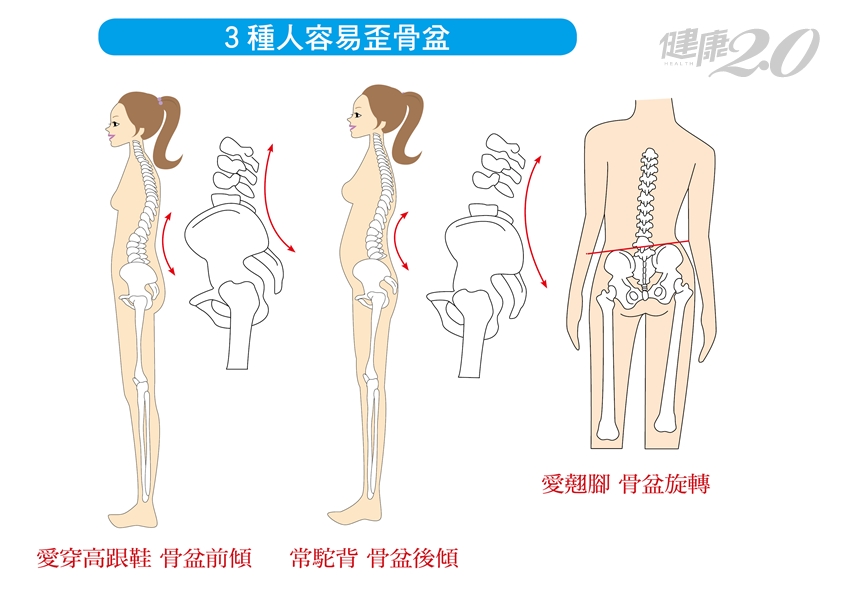 矫正盆骨瘦身美容 骨盆不正 難怪腰痠背痛好不了 ３生活習慣讓骨盆歪掉 1 愛穿高跟鞋骨盆前傾 危險族群 長期腰痠背痛 清晨起床腰部僵硬 習慣穿高跟鞋 2 常駝背骨盆後傾