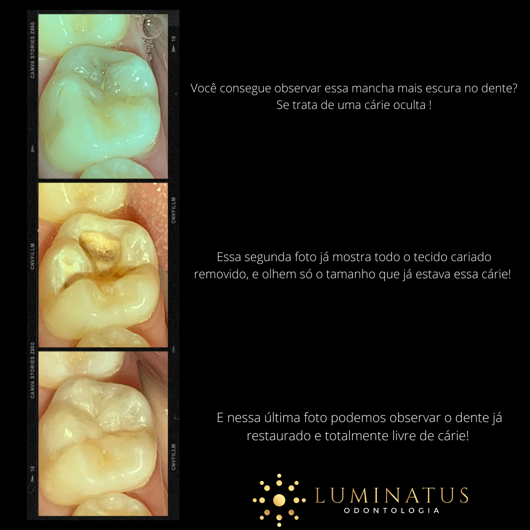 Luminatus - ️É importância estar sempre atento para...