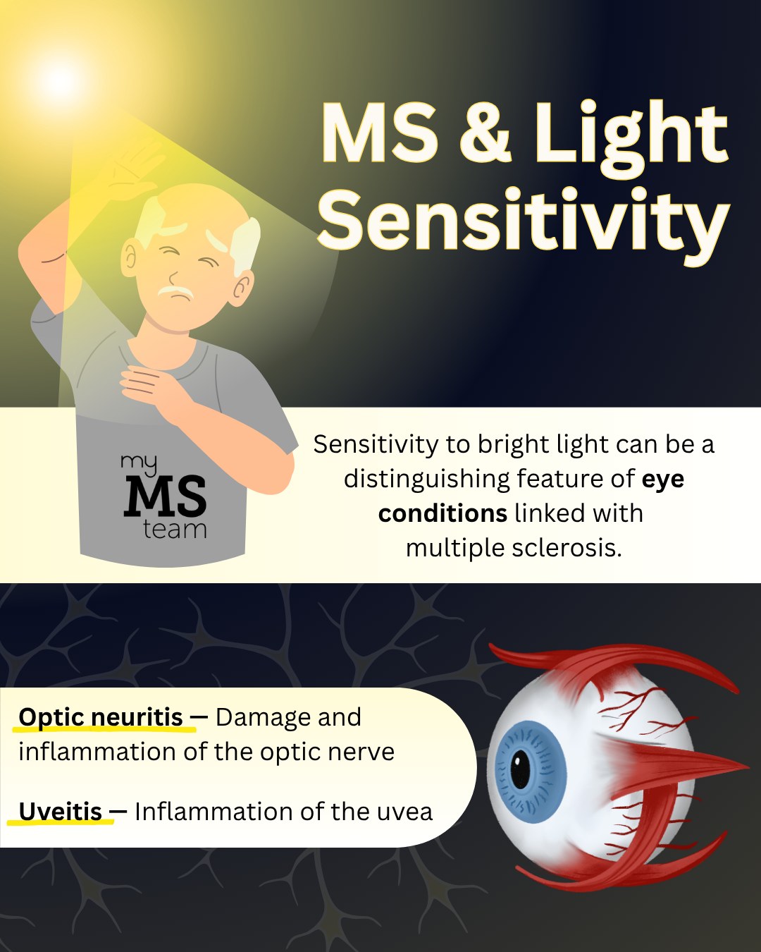 dihexa light sensitivity I started developing to after my MS diagnosis. I have severe light sensitivity in all light settings,” — MyMSTeam member. Photophobia, or photosensitivity, is a condition where light exposure is Pinched Nerve in Knee: