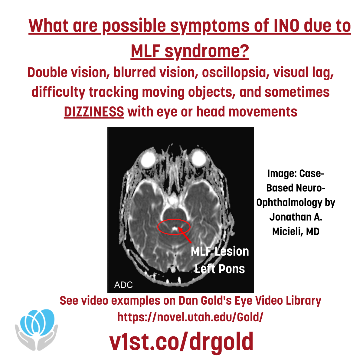 Do you know how to recognize signs of... - Vestibular First | Facebook