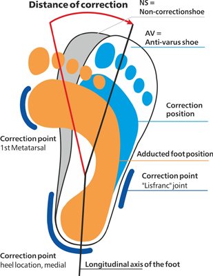 View of Orthopaedic &... - Orthopaedic & Diabetic Footcare Services