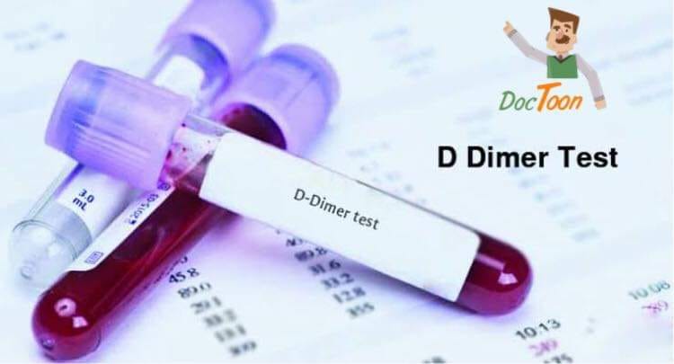 ما هو تحليل D Dimer تحليل كلية التقنية الطبية درنه Facebook