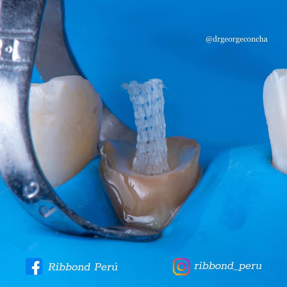 Ribbond Perú