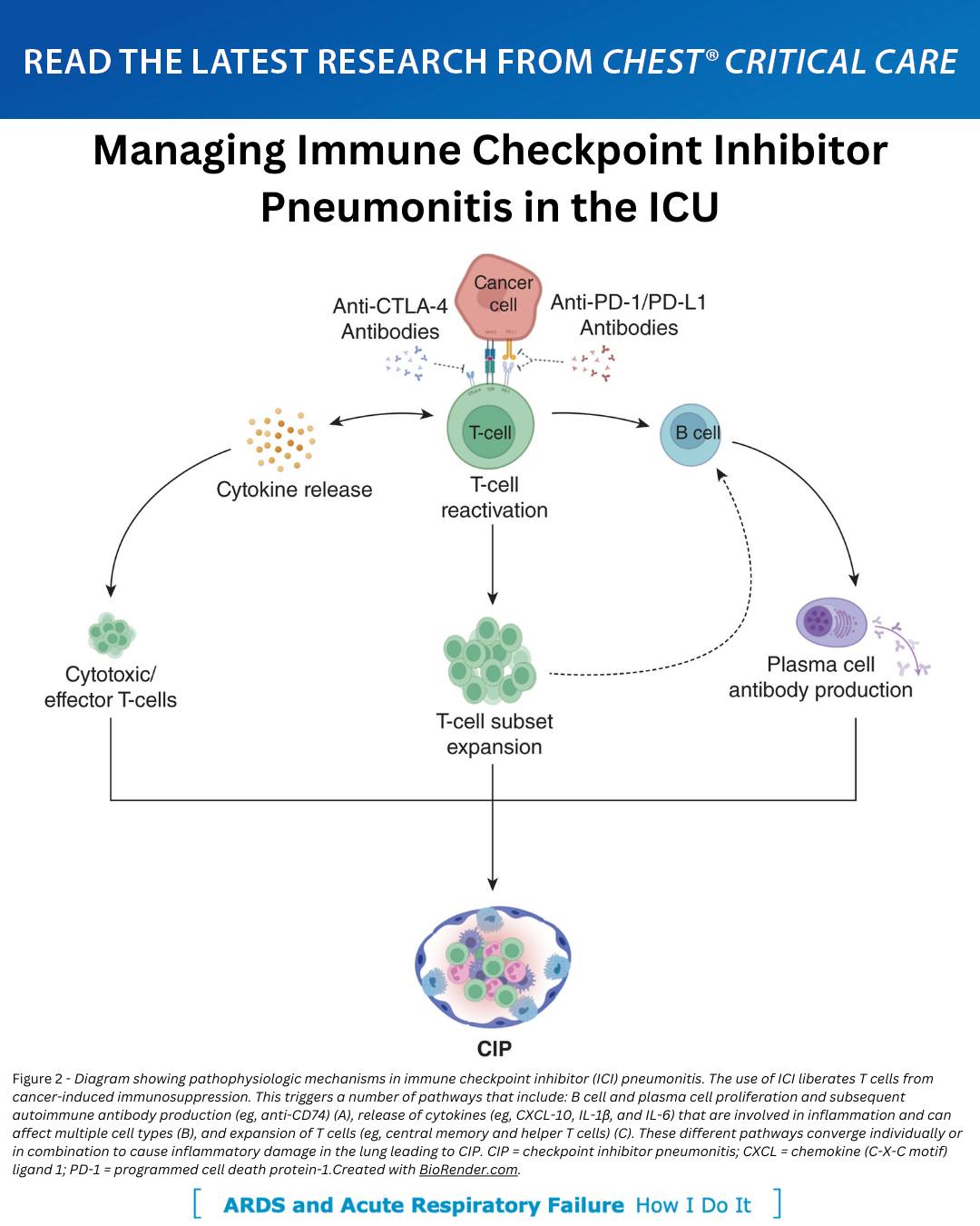 Managing Immune... - American College of Chest Physicians | Facebook