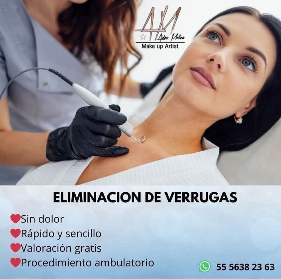 Calentador De Toallitas Húmedas Portátil Termostático - USB, Para Viajes, Coche, Casa, Ideal Para Bebés