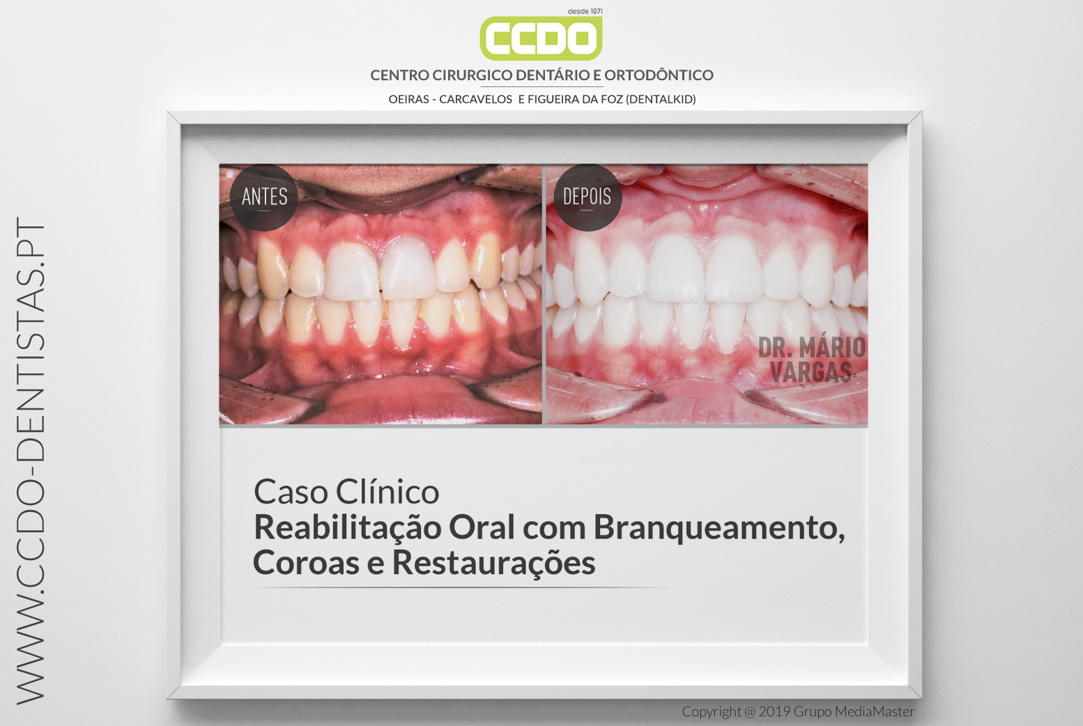 CCDO Dentistas - Apresento mais um caso clínico do CCDO....