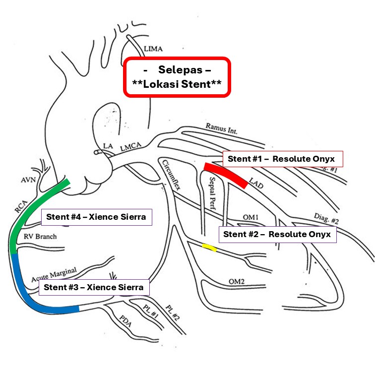 Dr.... - Dr. Muhammad Imran bin Abdul Hafidz, Cardiologist