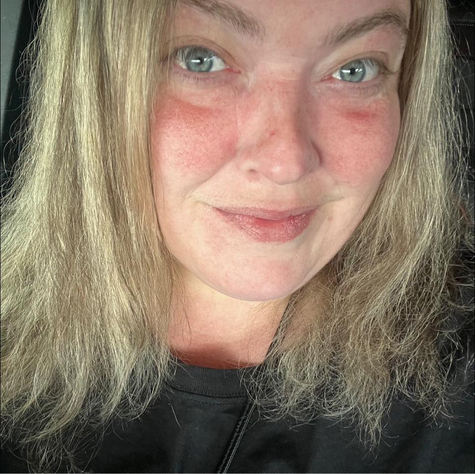 Toni Cornell - Radiologist called and said my lung is... | Facebook