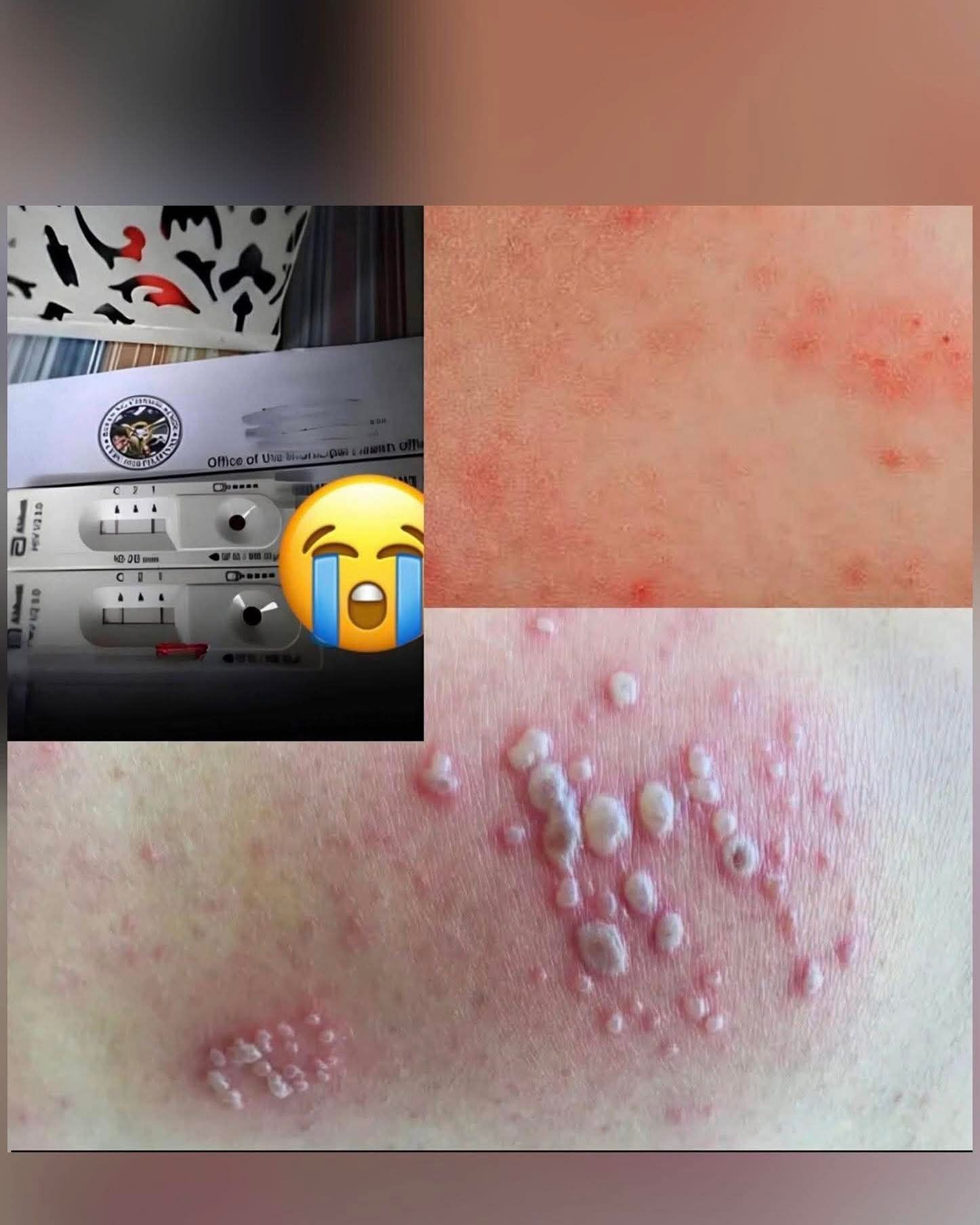 Ishiyama - Isang babae ang nagpunta sa emergency room dahil sa pamumula ...