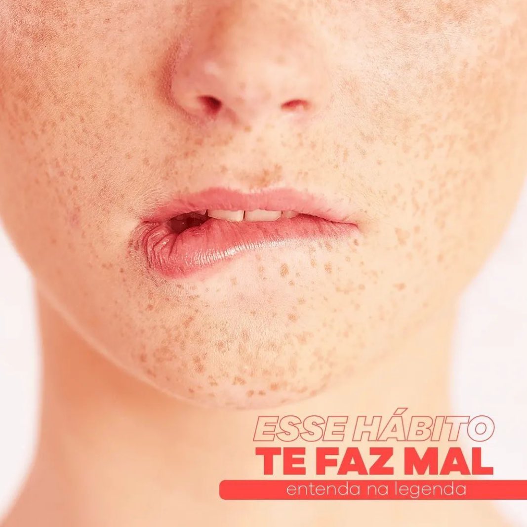 Sóbrancelhas - O hábito de lamber e morder os lábios expõe...