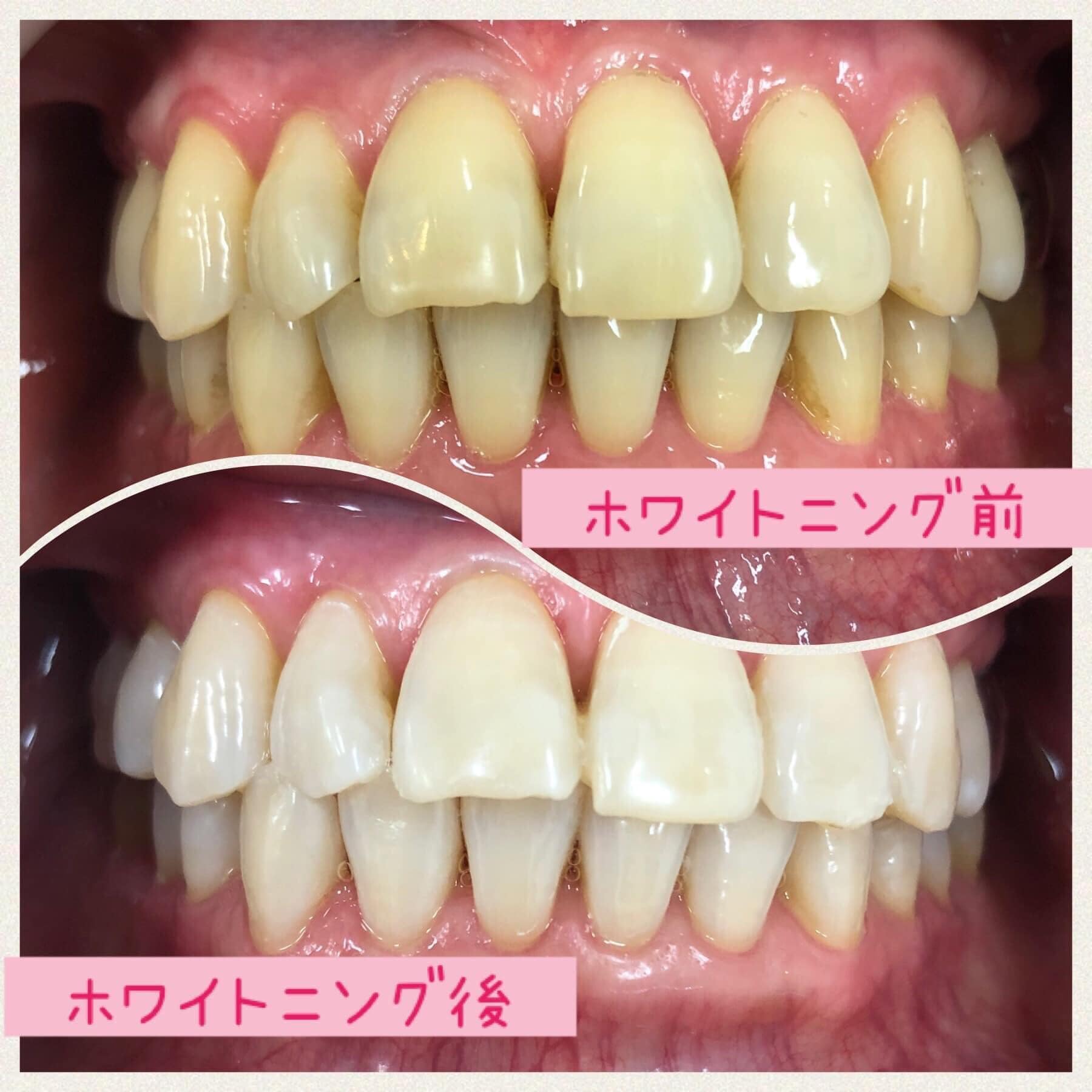 あやクリニック 歯科・皮ふ科 - 前歯って、見た目の印象にとても影響を与えています。...