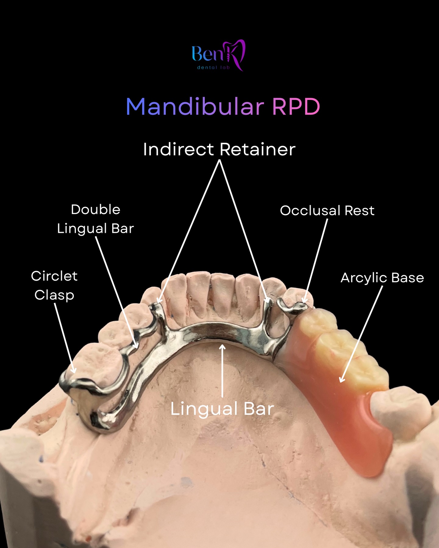 Ben K Dental Lab