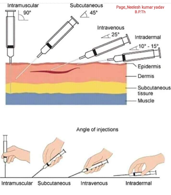 How to given Injection technique... - Dr Neelesh Kumar yadav