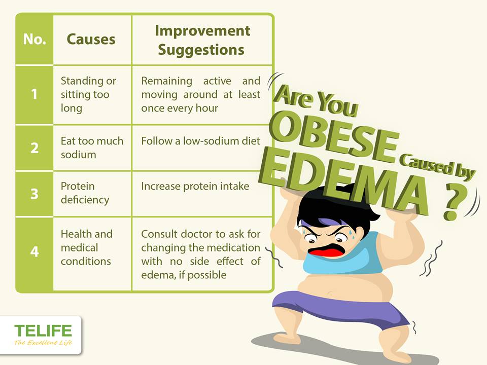 Tenutri - Are You Obese Caused by Edema? Edema is also known as water ...