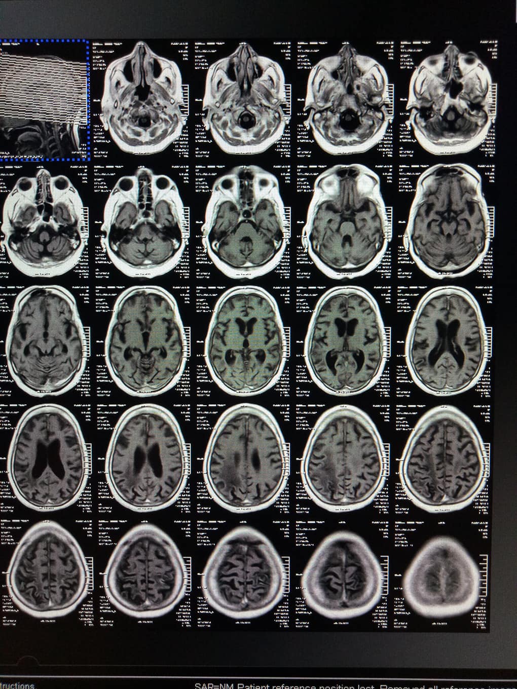 Pakistan Mri & Ct Scan Center Multan | Multaniwala