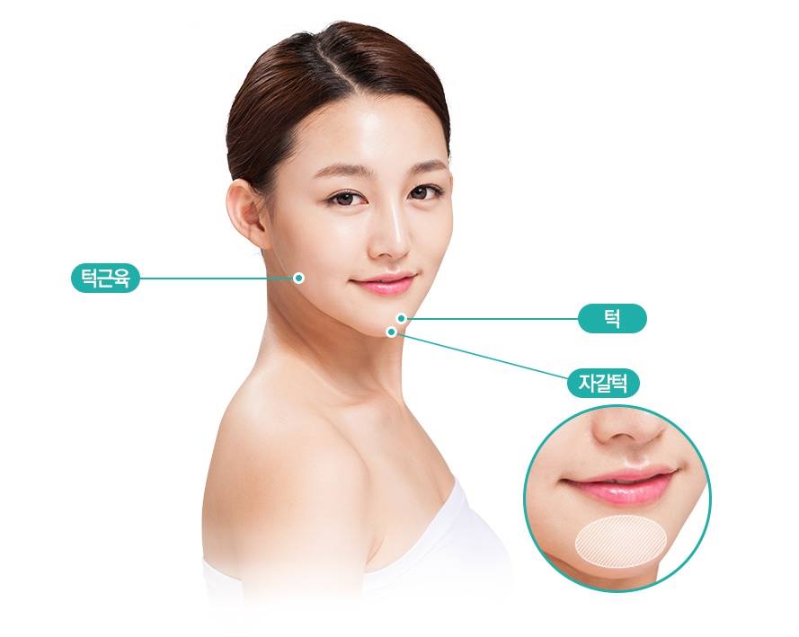 보셀르클리닉 대구 - 나의 턱끝, 더 완벽하게 완성할 수는 없을까? 일명 '자갈턱'이라고 불리는 턱끝을...