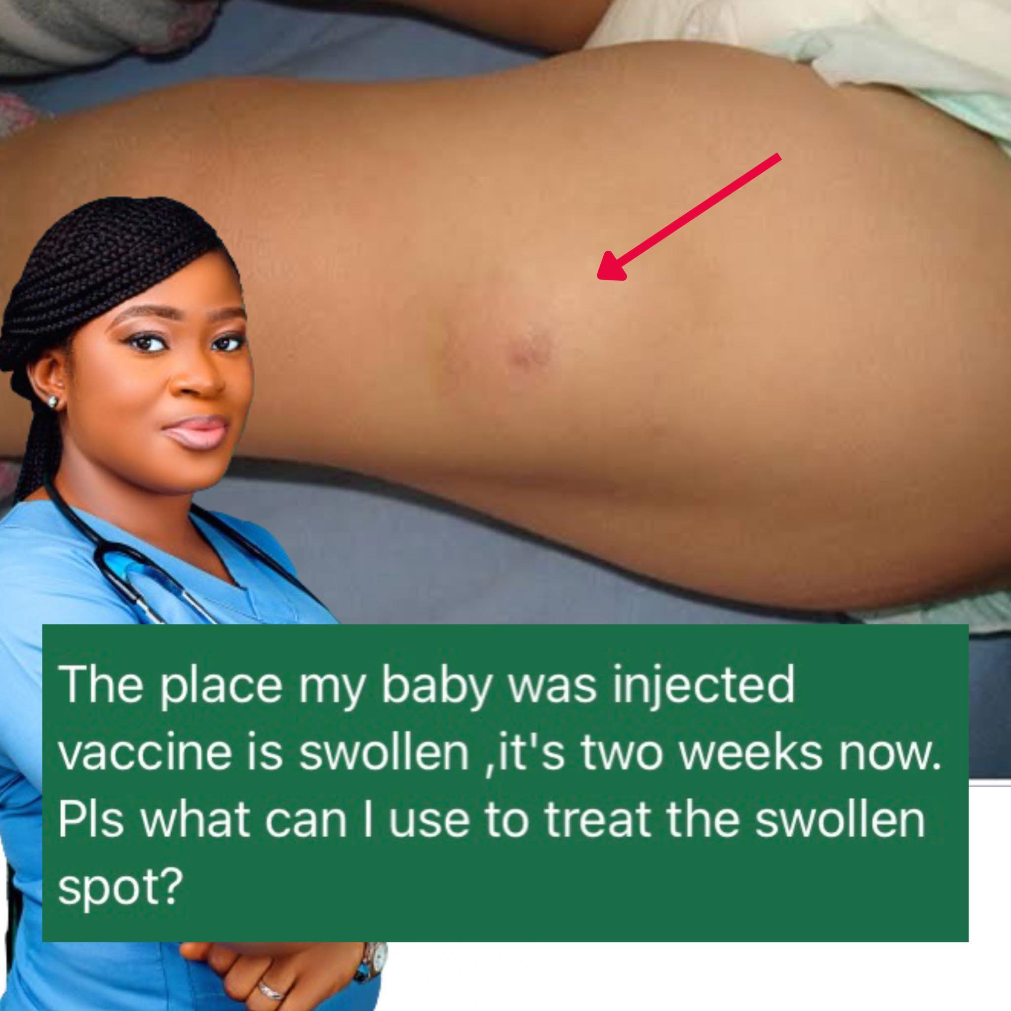 Are swollen injection sites normal after 4 month shots?