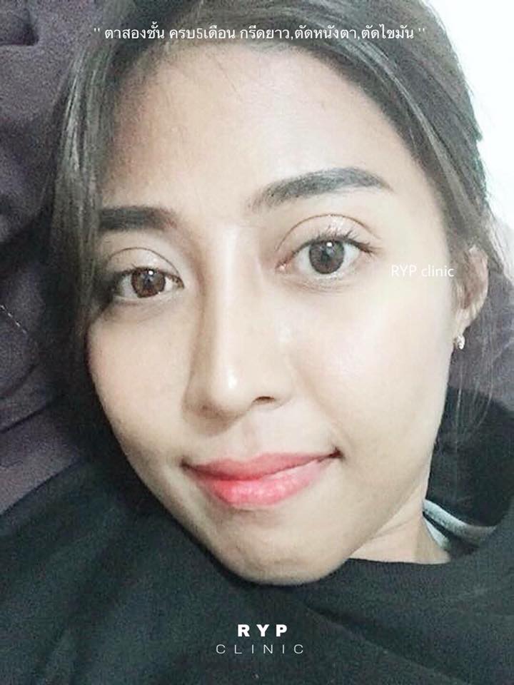 #สวยแค่ไหนถามใจ... - รินทร์ญาพัส คลินิก Rinyaphat Clinic - RYP
