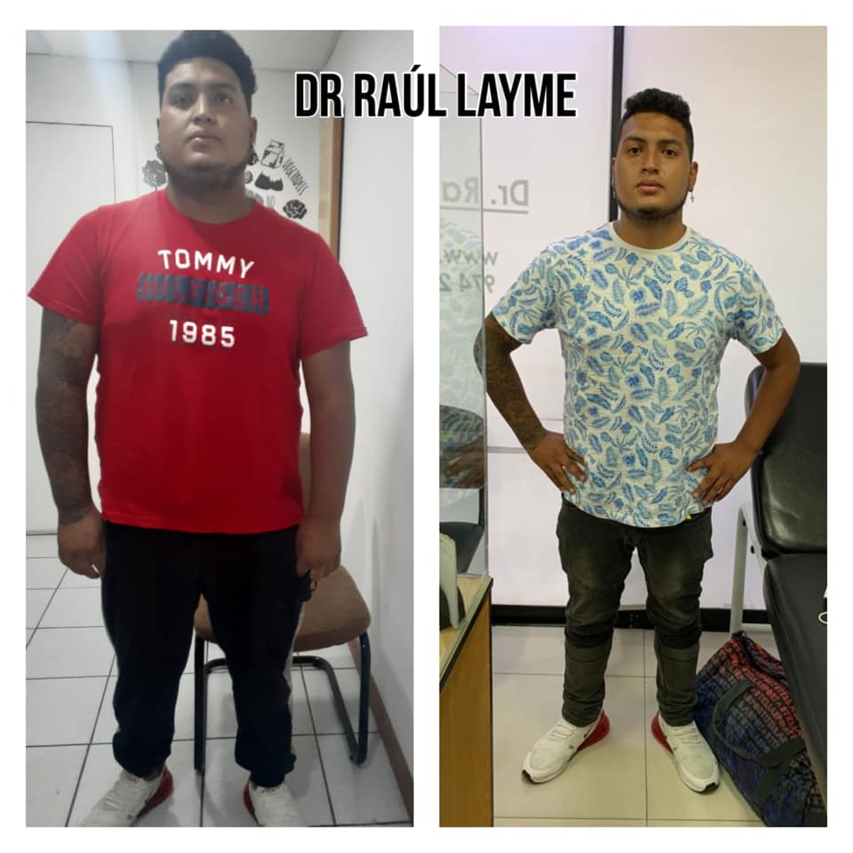 Edwin de Lima,... - Cirugía de Obesidad Perú - Dr. Raúl Layme | Facebook
