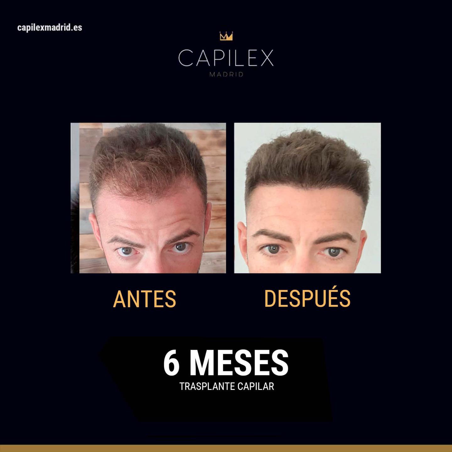 Capilex Madrid - ️Muy satisfechos por los magníficos... | Facebook