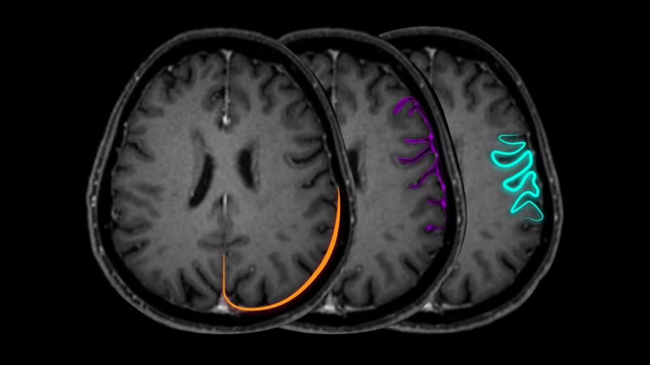 Basic-neuroimaging