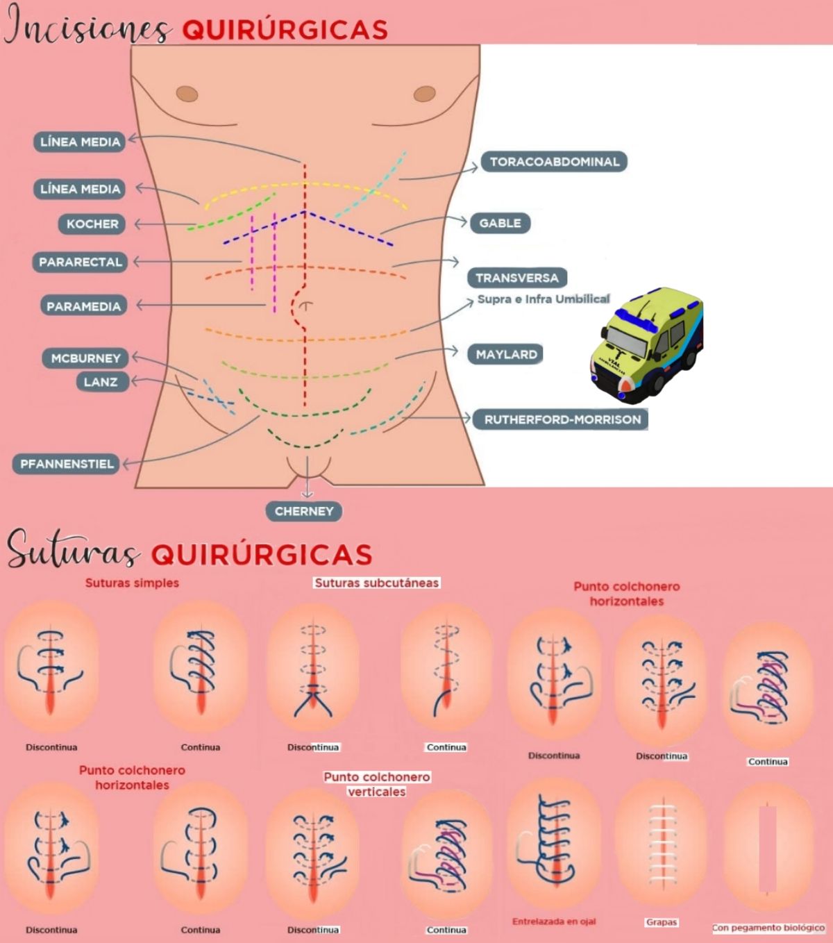 Vial - Incisiones y suturas quirúrgicas | Facebook