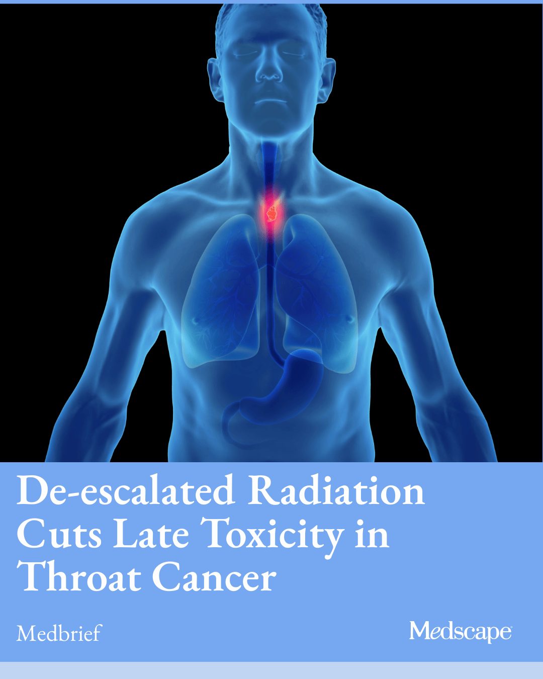 glutathione rectal implant Bioactive hydrogels in radiation sensitization and protection: New strategies and challenges glutathione rectal implant Which Ligands
