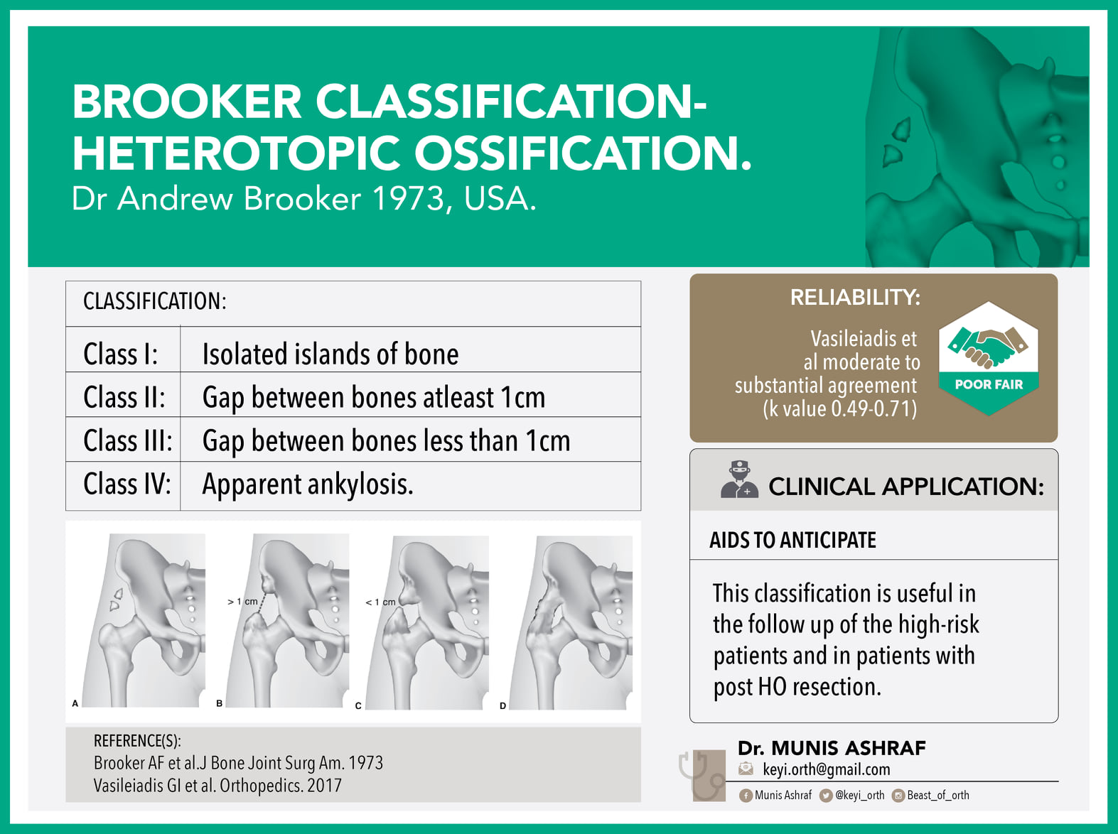 Orthopaedic Classifications & Current Concept Reviews