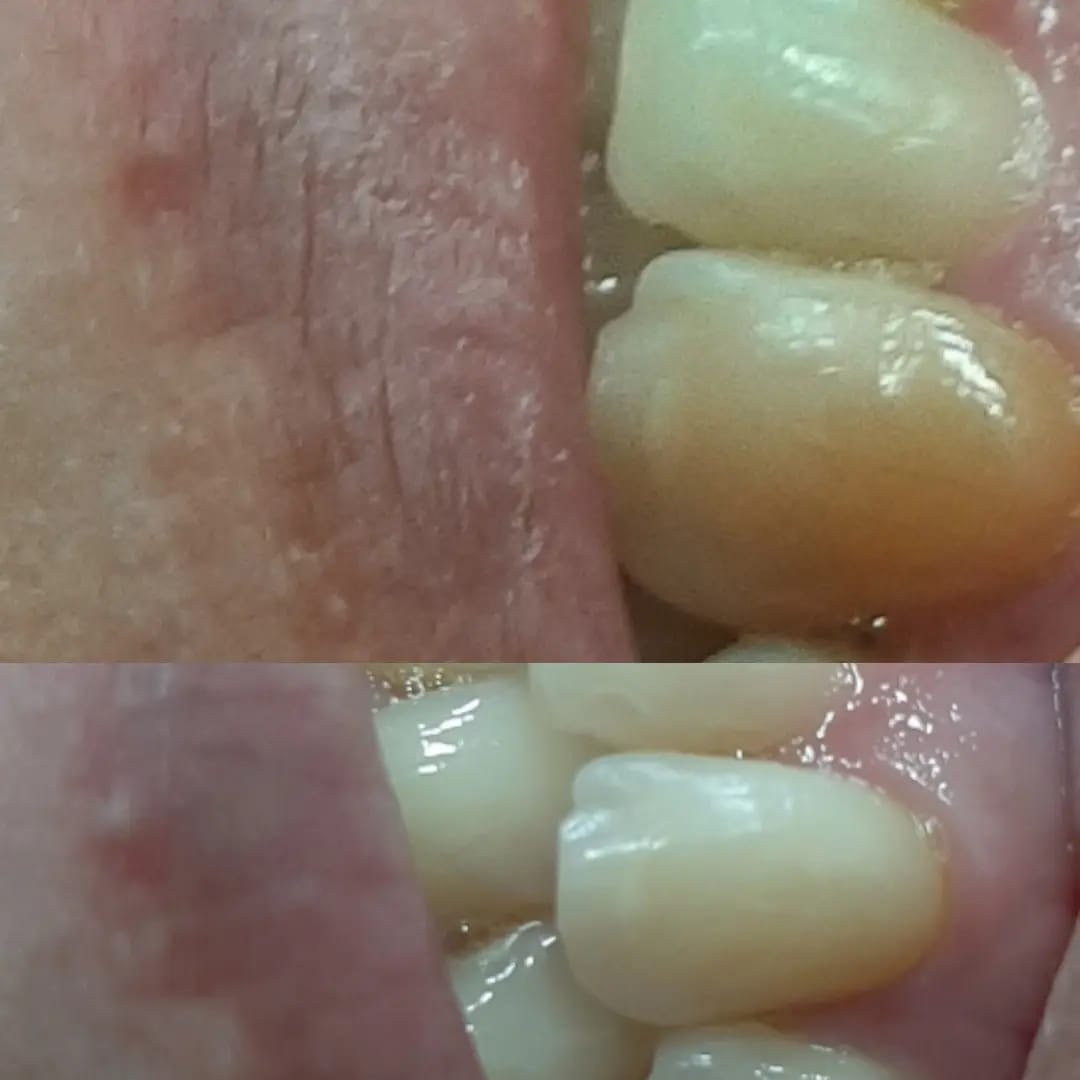 Para finalizar a nossa semana. O... - Luminatus Odontologia | Facebook