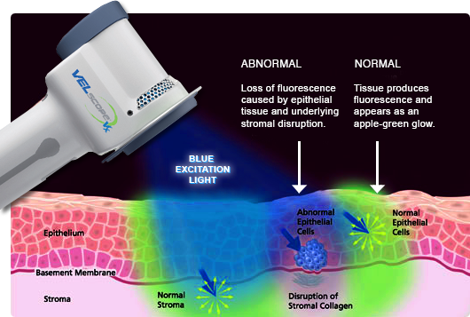 Holly - DID YOU KNOW? We have a Velscope at our office? It uses natural ...