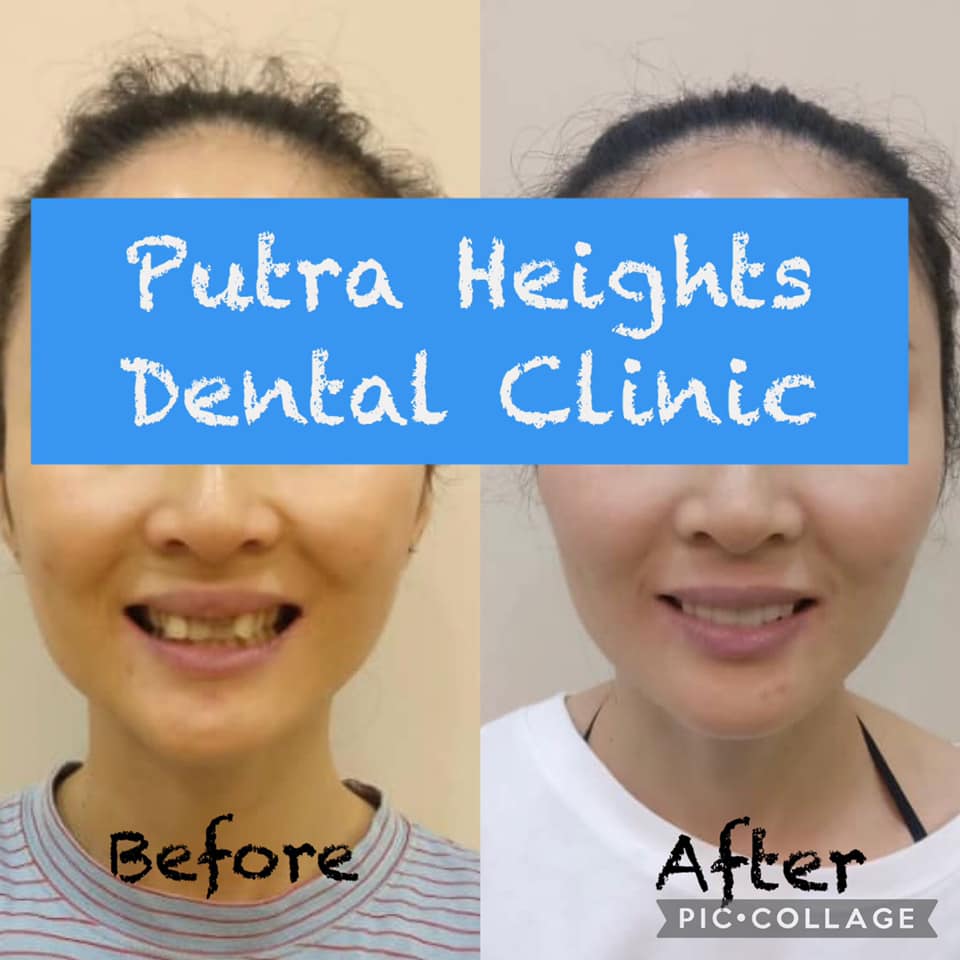 Putra Heights Dental Clinic Putra Heights Dental Clinic