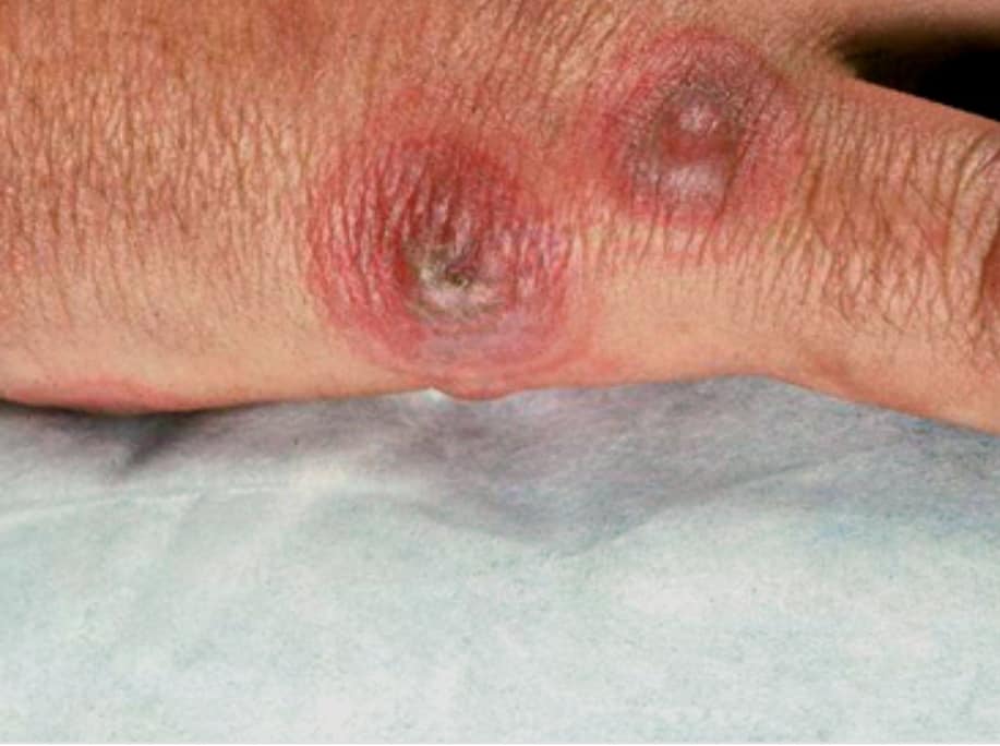 Diagnostico VYM - ️Consultorio de Dermatologia👩‍⚕️🏥...