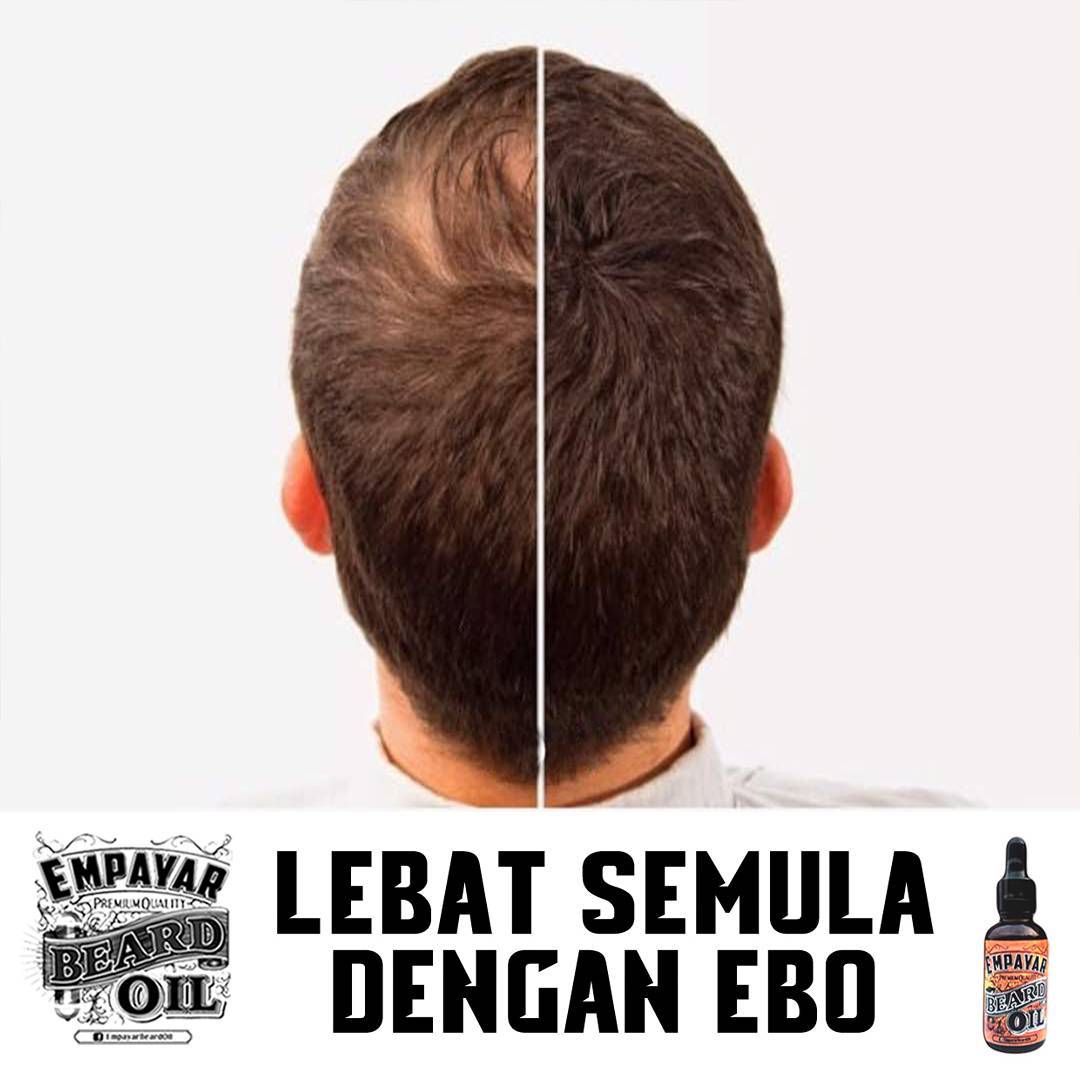 Empayar Beard Oil Rambut Selalu Gugur Ada Masalah Rambut Nipis Dan Jarang Tak Tahu Cara Nak Lebatkan Rambut Seawal 2 Minggu